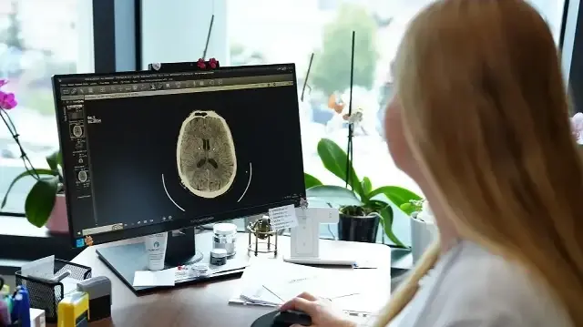 kume bas agrisi nedir belirtileri nelerdir uzmanindan onemli uyarilar iC2luLmi.webp