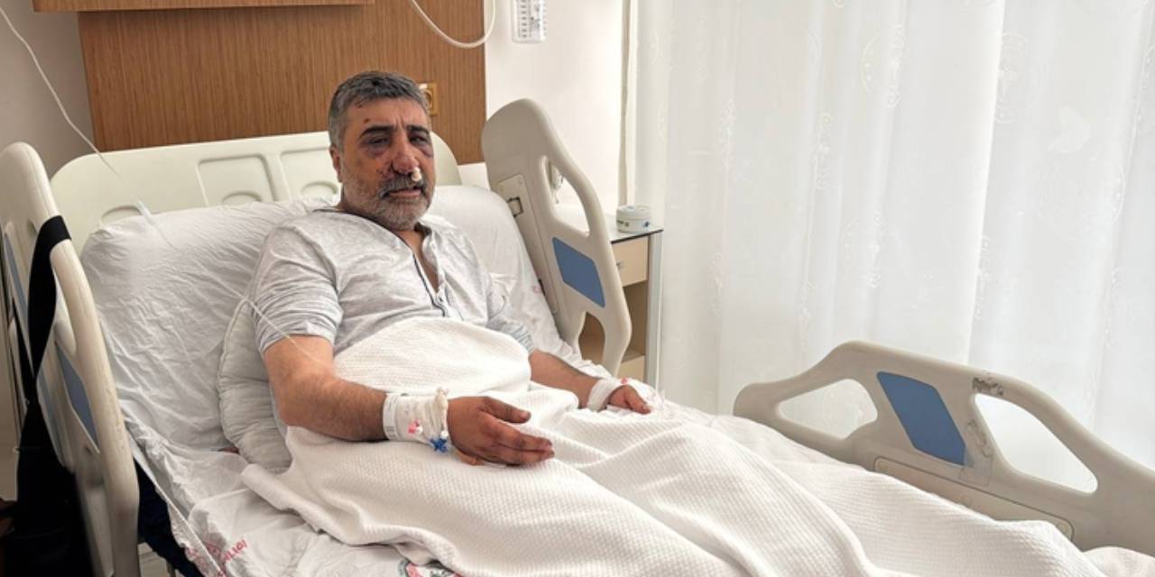 ingiliz boksorun darp ettigi taksicinin davasi goruldu geceleri bagirarak uyaniyorum B5DuZIIS.jpg